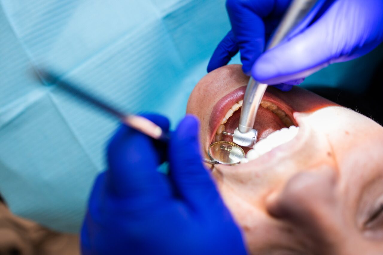 Dr. Zöllner schleift einen Zahn